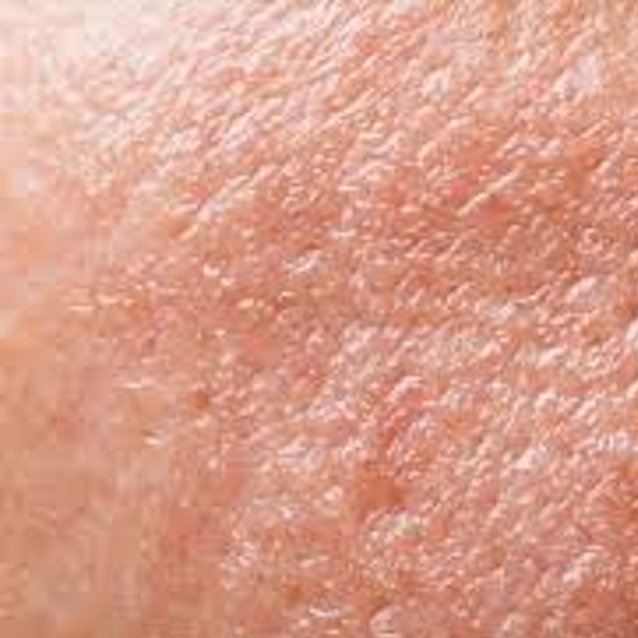 Clogs Your Skin